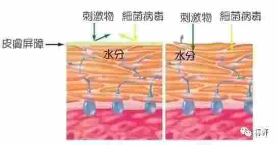 皮肤红血丝怎么办？